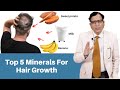 Top 5 Minerals for Hair Growth | अच्छे बालों के लिए क्या खाएं | Dr. Anil Garg