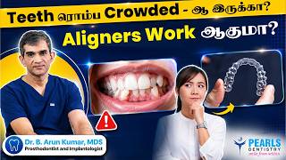 Teeth ரமப Crowded-ஆ இரகக? Aligners Work ஆகம? Clear Aligners Explained Pearls Dentistry