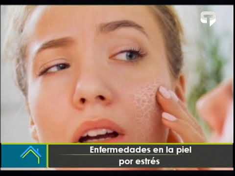 Enfermedades en la piel por estrés