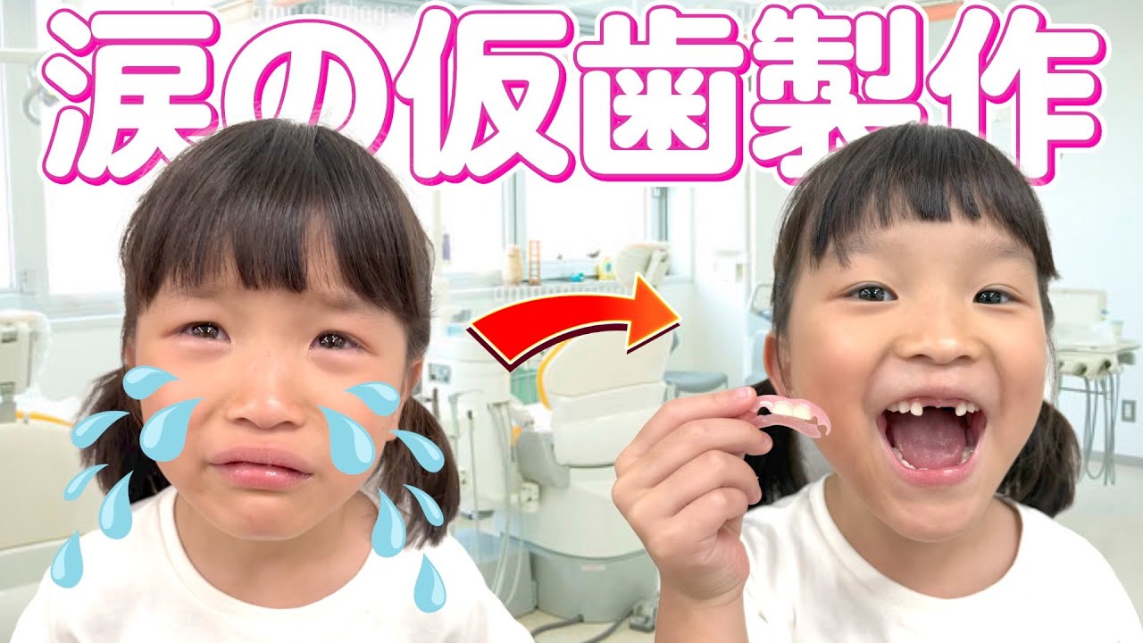 Making temporary teeth] The dentist was scary after all