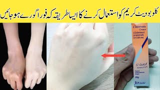 Clobevate Hand whitening Cream Review,Price,Side effects,Benefits feet fairness Cream