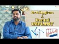 Oral hygiene  dental implant  dr prem alex lawrence in tamil