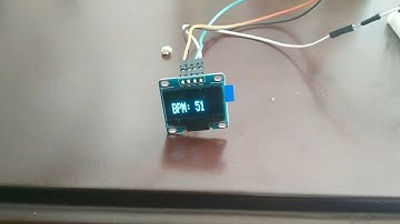 Sensor de Pulso con Arduino,Matlab y pantalla OLED
