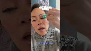 Focused Eye Roll for MGD #eyecare #meibomianglanddysfunction #dryeye
