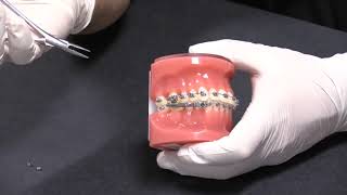American Orthodontics PowerScope 2 Class II Corrector Activation Process