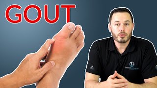 Understanding Gout // Causes, Triggers and Treatments