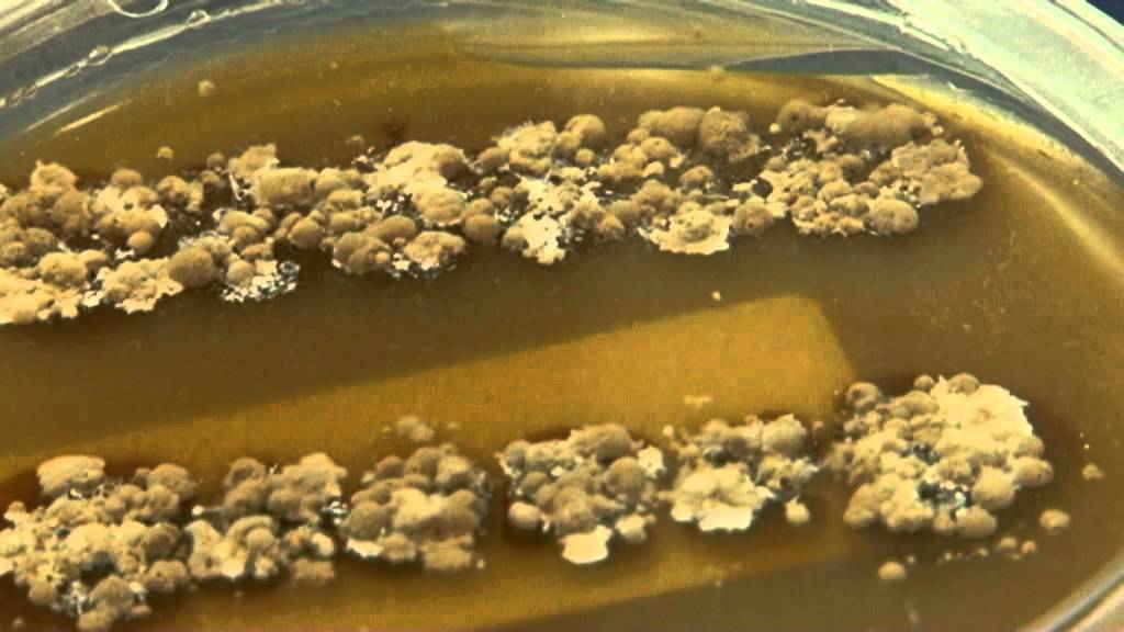 Desarrollo de un fármaco