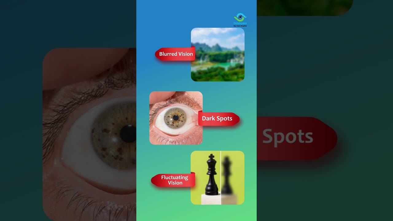 Best Eye Care Habits for Diabetic Patients to Prevent Blindness