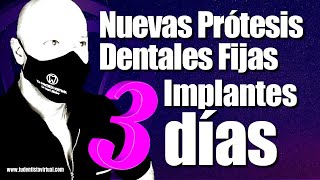 SORPRENDENTE forma de REEMPLAZAR Todos los DIENTES con estos Nuevos Implantes