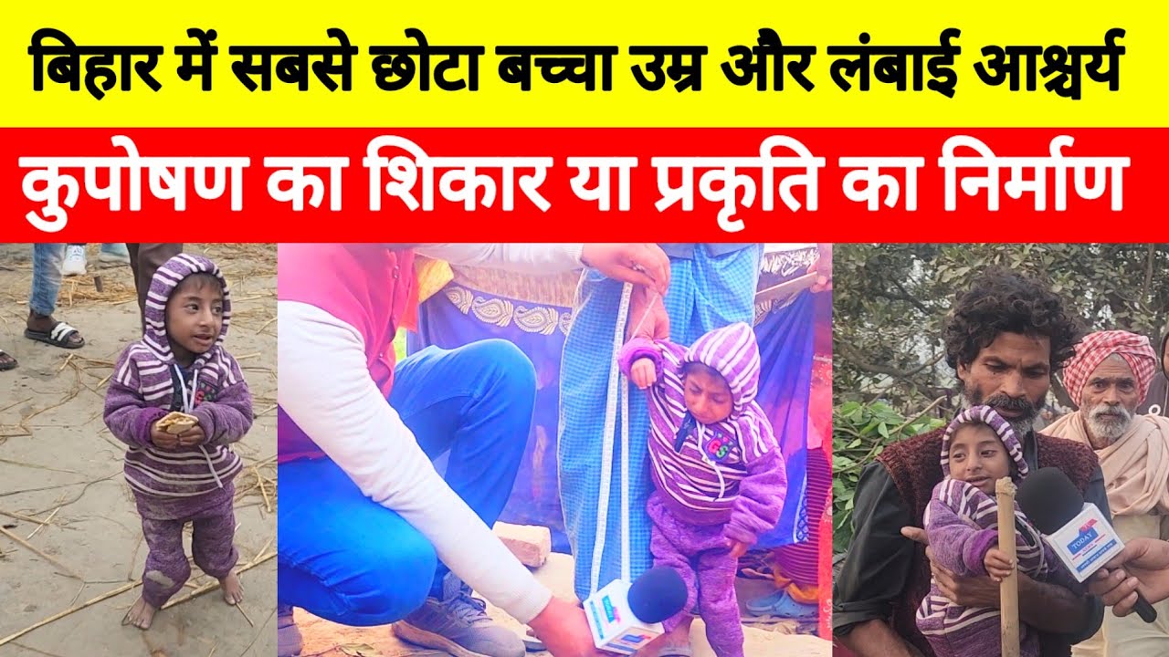बिहार में सबसे छोटा बच्चा उम्र और लंबाई जानकर हर कोई हैरान #bihar # ...