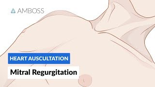 Mitral Regurgitation (MR) - Heart Auscultation - Episode 4 screenshot 3