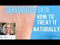 DEHYDRATED SKIN | HOW TO TREAT IT | NATURALLY!