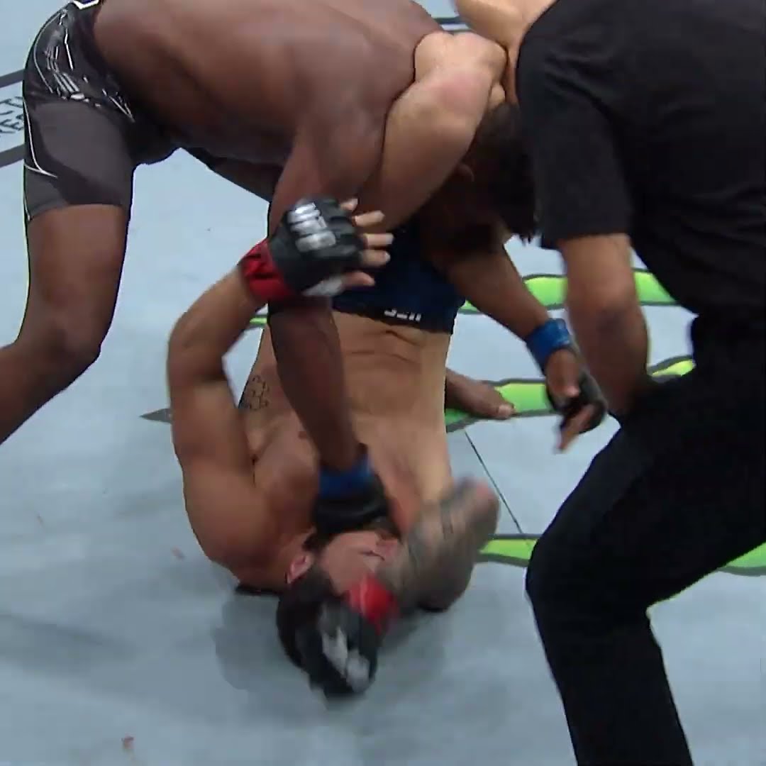 OMG BROKEN ARM ? #nocommentary