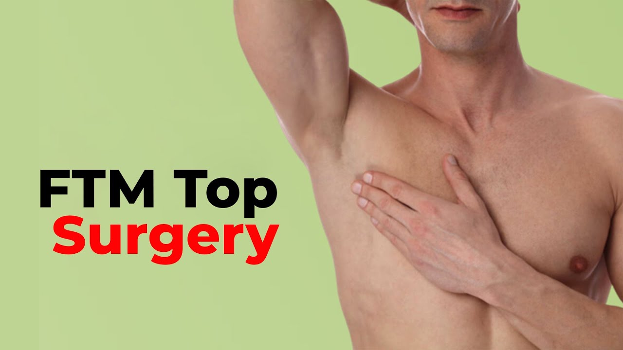 Keyhole FTM Top Surgery Female to male surgery transgender YouTube