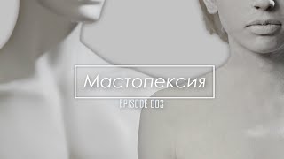 VLOG 3: Мастопексия