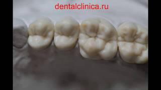 Эстетическая реконструктивная стоматология, доступные цены отзывы пациентов, улыбки на лицах(, 2014-04-09T08:39:19.000Z)