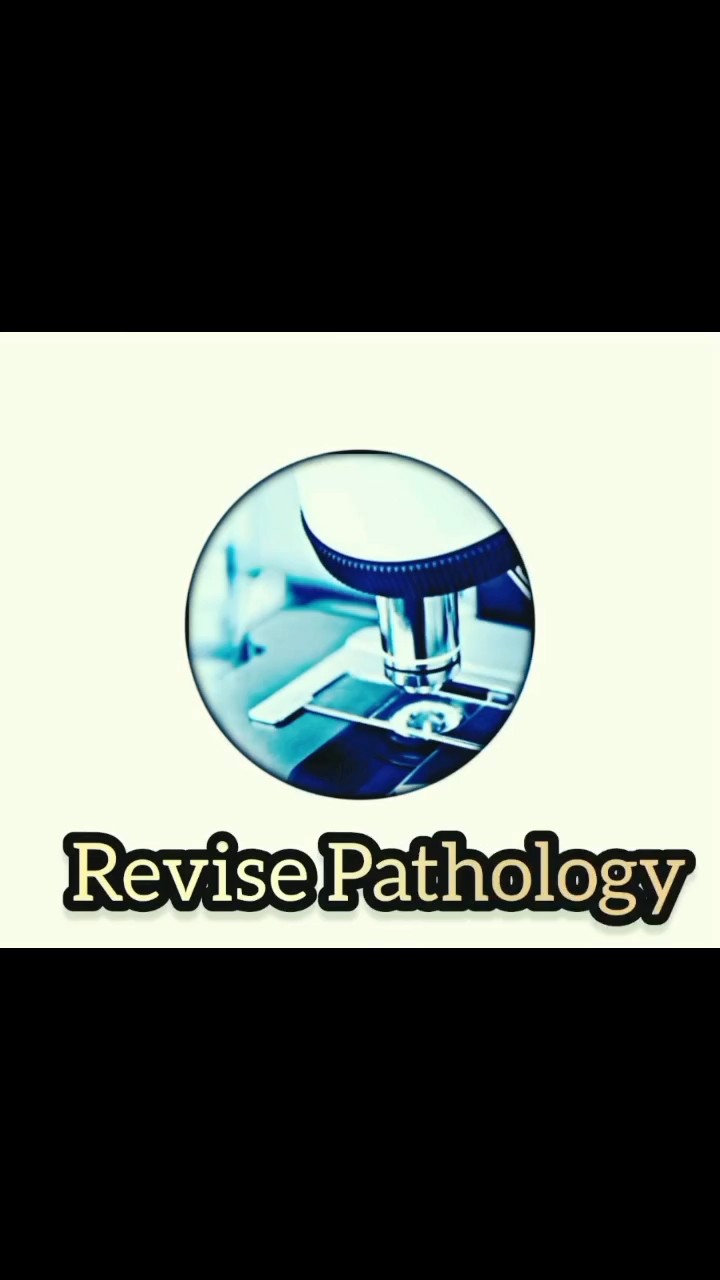 Types Of Renal Calculi Or Renal Stones revisepathology renalcalculi Types Of Renal Calculi Or Renal Stones revisepathology renalcalculi