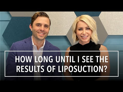 Liposuction Final Results... ETA?