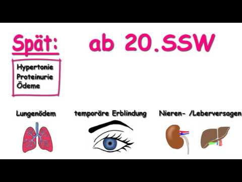 Video: Behandlung Von Präeklampsie: Magnesiumsulfat-Therapie