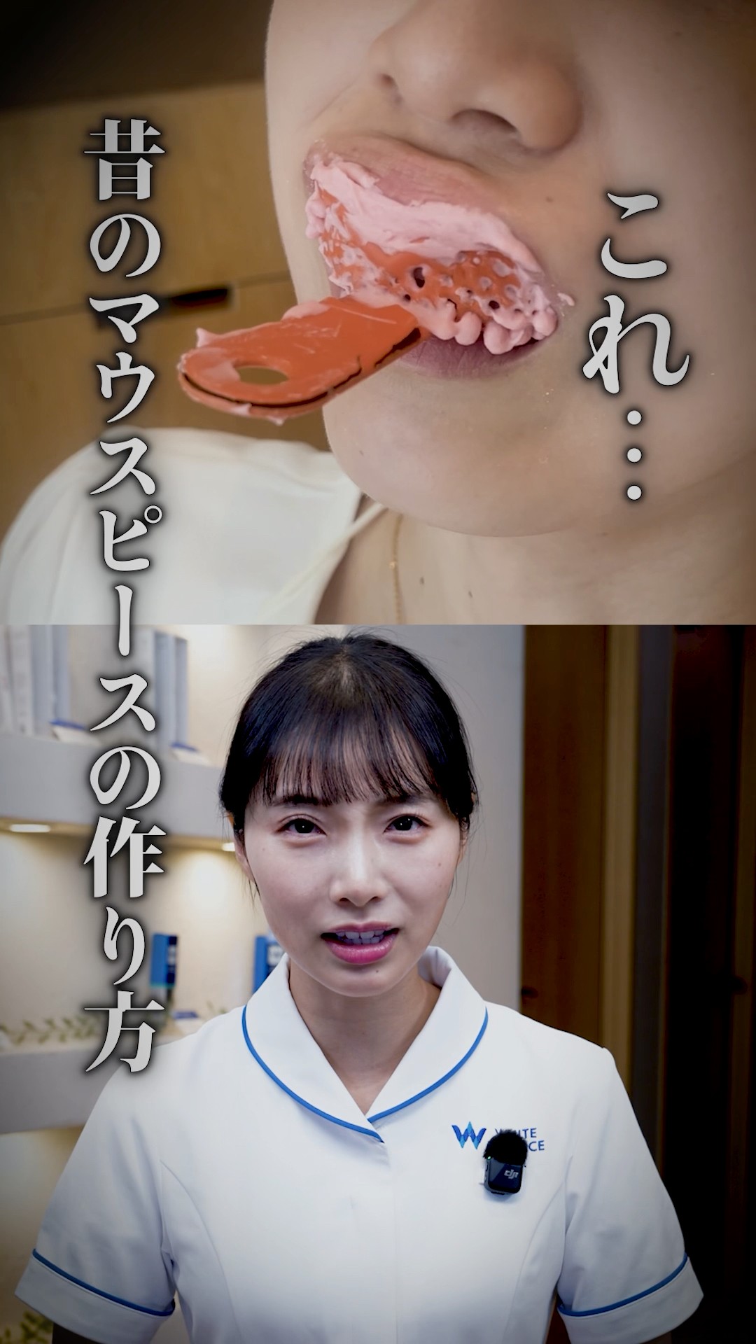 ホームホワイトニング】たった30秒の型取りで終わるマウスピースの秘密