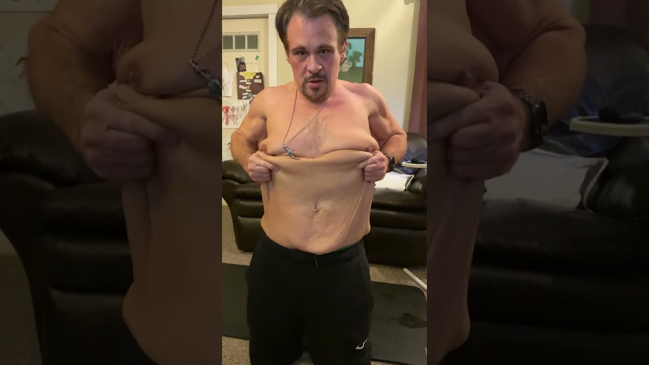 Before and after skin removal.