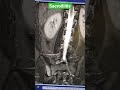 Right side sacroiliitis. #mri #ct #mri #viral #viralvideo #shorts