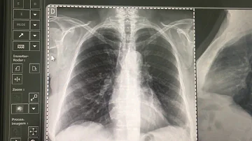 O que é um CR radiologia?