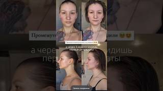 гимнастика лица!  ПОДПИШИСЬ чтоб узнать все о волосах! #стилист #стрижка #парикмахер