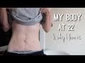 My Body at 22.. let’s talk about it.
