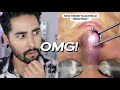 The Best / Most Shocking Dermatologist Advice From TikTok 2 ✖  James Welsh