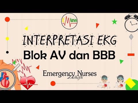 Video: Blok Atrioventrikular - Penyebab, Jenis, Pengobatan