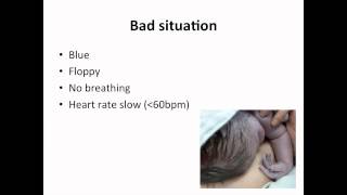 Paediatrics - neonatal resuscitation