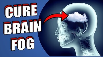 Brain fog - Avoid These 4 Things To Cure Brain Fog
