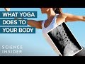 Understanding Yoga: Benefits and Misconceptions
