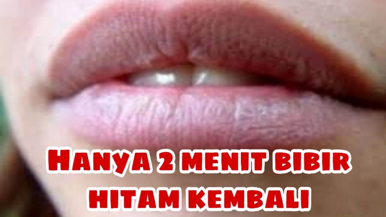 Cara menghilangkan bibir hitam - YouTube