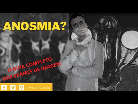 Vídeo: Por que anosmia na síndrome de kallmann?