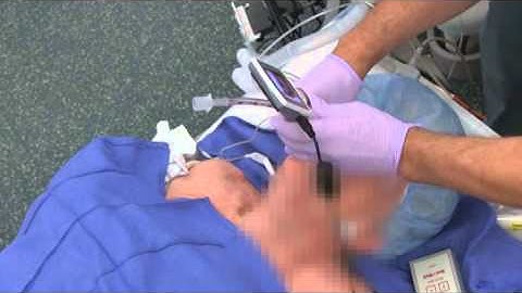 KingVision aBlade reissue from AOD