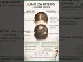 Hair Loss Patterns You Should NOT Ignore ⚠️ (Know the Cause)