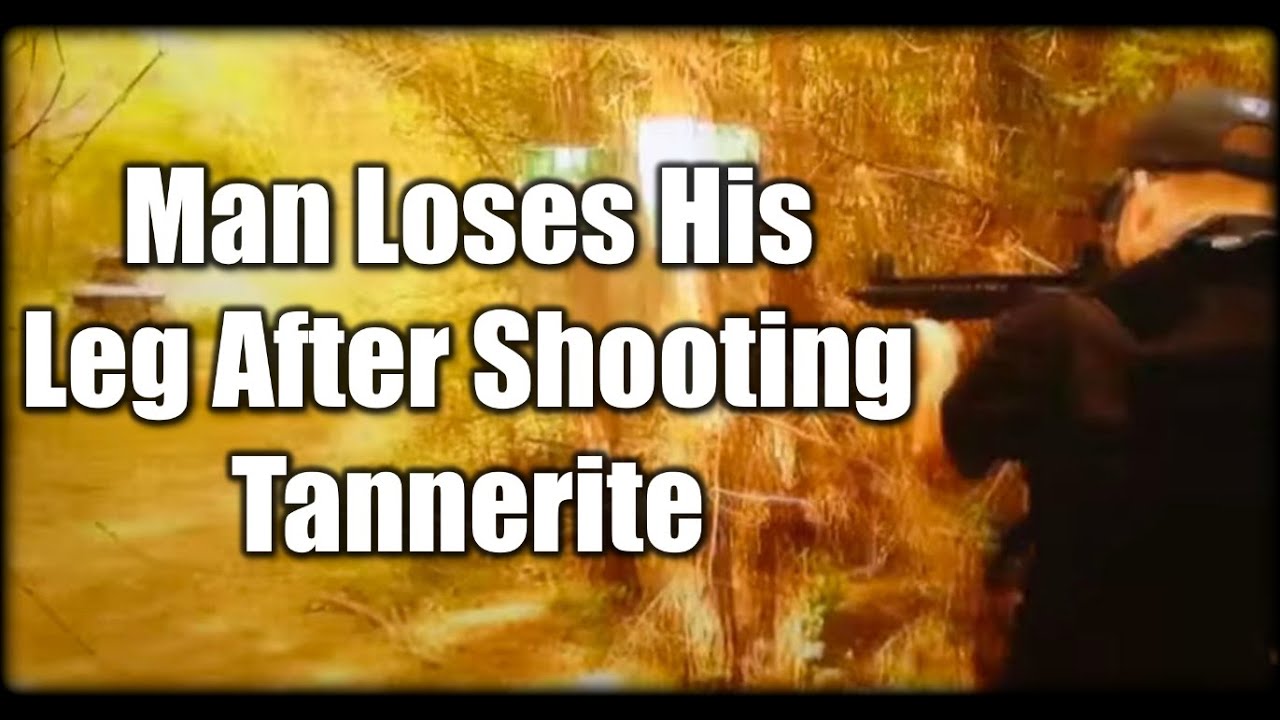 Man Loses His Leg After Shooting Tannerite