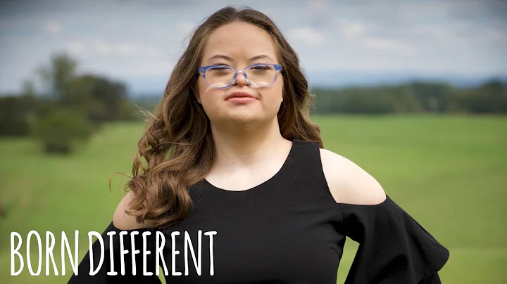 Model With Down Syndrome Launches Fashion Line | B...
