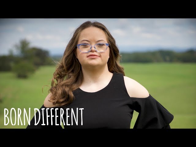 Woman with Down's syndrome criticises  over offensive clothing