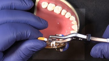 Introducing the New Garrison Premier Forceps