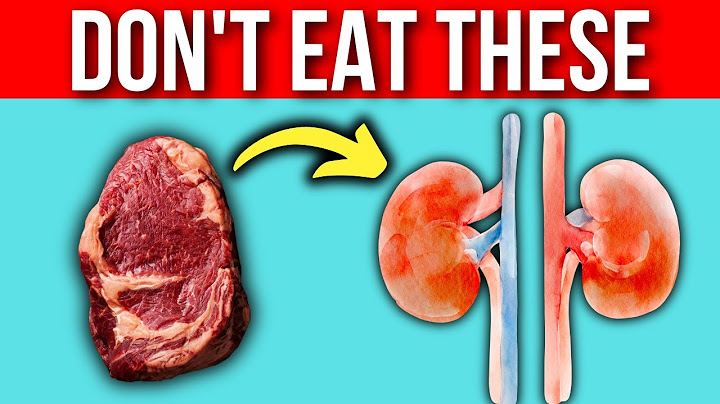 STAY AWAY From These 8 Foods if You Want To Keep Your Kidney Healthy!