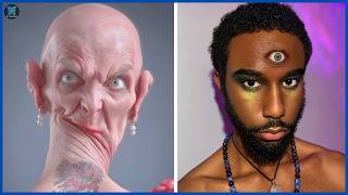 These Rare Individuals Were Born Different — Their Real Stories Will Amaze You