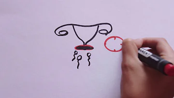 Jaké jsou bariérové Druhy antikoncepce?