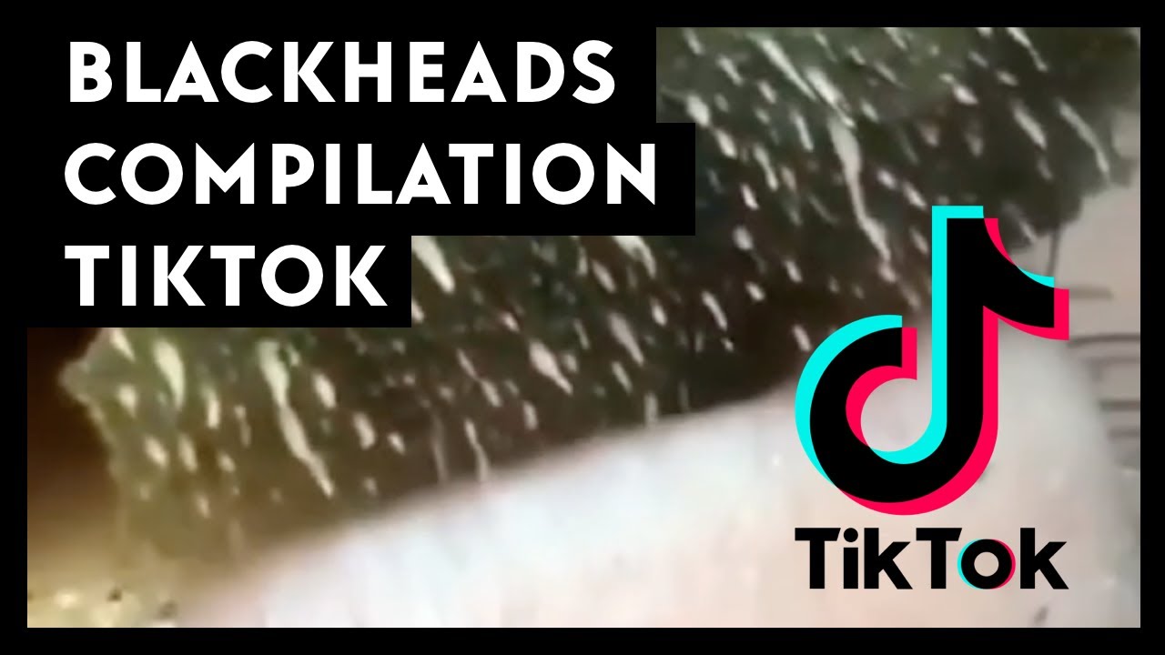 Satisfying Blackheads Pore strip compilation tiktok 1 YouTube