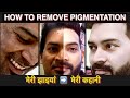 How to Remove PIGMENTATION (Melasma) Naturally. मेरी झाइआ, मेरी कहानी