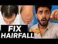 “5 Hairfall Mistakes Every Man Is Making (Stop These TODAY)”⭐️