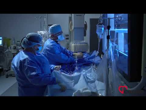 Video: Kako se izvodi angiogram?