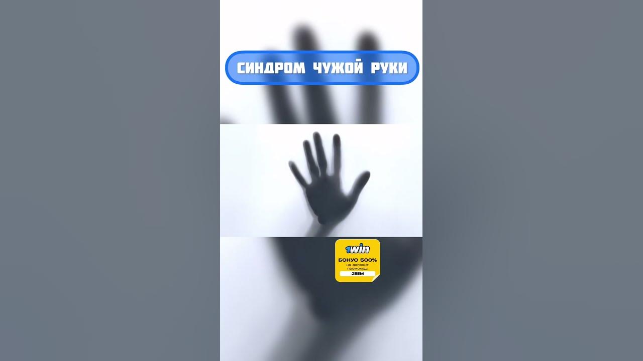 Синдром чужой руки #факты #tiktok #shorts - YouTube